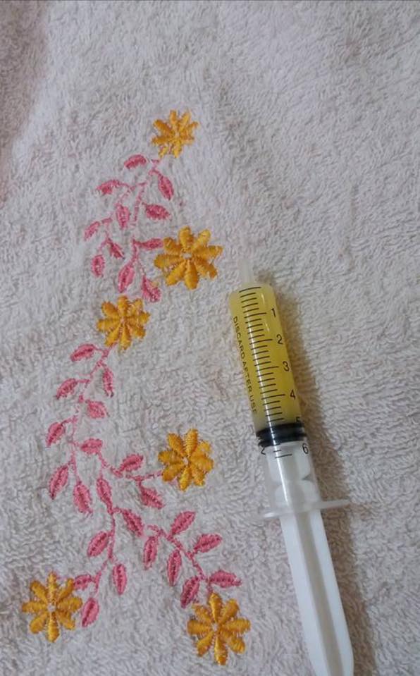 VƯỢT CẠN THÀNH CÔNG

Hôm nay tớ chính thức cho con đủ 72H VÀNG SỮA NON Rồi ạ. 
Điều tớ làm được cho con là: 
- da tiếp da 
- Chậm Kẹp dây rốn 
- Cho con đủ 72h vàng sữa non, không tráng ruột sữa công thưc
- Qua 24h mới tắm cho con. 
Tớ kể một chút về cuộc sinh nở của tớ cho các mẹ nghe nhé. 
Hy vọng khi nghe xong nếu mẹ nào một lần nữa sinh em bé có thể học hỏi để có thể sinh và nuôi con dễ dàng hơn. 
Trộm vía Dâu Tây nhà tớ sinh ra đươc 4,2kg , sinh thường, và tớ không bị rạch tầng sinh môn. 
Các mẹ ib hỏi t là 
-sao chị giỏi vậy, em bé to vậy mà chị sinh thường và không bị rạch 
- sinh xong chị có cho bé tráng ruột sữa công thức không? 
...................
Thật ra tớ không có giỏi gì cả, sức khoẻ tớ cũng không được cho là tốt, chỉ là tớ đã chuẩn bị hết cho cuộc sinh nở lần này kĩ càng hơn thôi ạ.

Có mẹ nào dám bảo đẻ không đau . Đau muốn chết ý, đau đến nỗi người ta rách thịt da mà không biết( trừ những mẹ sinh mổ)

Vào đúng ngày dự sinh tớ vẫn chưa sinh các mẹ ạ. Buổi sáng tớ vẫn tập yoga tập thở tập rặn thai giáo cho con là 
" Dâu Tây ơi hôm nay là đến ngày con gặp bố mẹ và anh Ben rồi đấy ra đi để gia đình mình gặp nhau nhé" . Dậy ăn sáng và không quên đi tắm ra tiệm gội đầu đắp mặt matxa thư giãn, trưa vẫn đủng đỉnh hẹn hò với các chị trong công ty Famicook ăn một bữa hải sản hoành tráng , chiều vẫn cà phê với mẹ Thảo. Chuẩn bị trước rất sẵn sàng các mẹ ạ.

Tối đến 23h tớ bắt đầu có cơn co, nghĩ bụng cuối cùng thì cũng đến cái ngày định mệnh, chuẩn bị mà chịu trận ( vẫn bị ám ảnh lần trước suýt kiệt sức không đẻ được). Rút kinh nghiệm đợt 1 thôi thà nằm nhà chờ tý nữa rồi đi, trời lạnh này đến bệnh viện chưa đẻ được vật vờ 5,6h đồng hồ thì chết trời lạnh thế này ( nhà gần bệnh viện nên liều thôi ạ) đến 0h không chịu nổi nữa mới bò dậy gọi chồng , lão vẫn đang bảo a nốt ván đã (khổ mê game các mẹ ạ) cố dậy thay đồ xong xuôi 0h30 vk ck tớ xuất phát đến bệnh viện đến nơi kiểm tra mở 5p rồi. Số rất may gặp chị đỡ đẻ lần trước, nhanh chóng làm thủ tục để lên bàn đẻ. Trong lúc chờ Cố hít thở đúng để không bị đau nhiều.

Lên bàn đẻ đau lắm rồi vẫn thều thào với chị hộ sinh :Chị ơi đừng rạch tầng sinh môn của em nhé , chị yên tâm e sẽ rặn đúng để con ra nhanh ạ, con sinh xong chị để nguyên dây rốn cho bé năm lên người em để da tiếp da, chờ dây rốn ngừng đập rồi hẵng cắt chị nhé! 
Chị hộ sinh: em siêu âm được mấy kg? 
Em: dạ 3,6kg ạ 
Chị hộ sinh : oke . Chuẩn bị đẻ nhé. 
Vẫn không quên dặn tớ, bao giờ chị bảo rặn mới được rặn đấy nhé, rặn sớm rách kệ em đấy.

Chuyện gì đến rồi nó cũng đến Mặc dù biết trước là sẽ rất đau, nhưng không nghĩ lại đau đến cái mức không thể chịu nổi như thế đâu các mẹ ạ. Tớ gào thét như một con chó điên ấy. Cố rặn thở đúng để em bé ra đời một cách dễ dàng hơn. Vì lần sinh đầu vì không biết cách thở cách rặn mà tớ sinh rất khó, sắp hết hơi, cạn hết sức mà bé vẫn không ra được, nhờ có một anh bác sĩ đi mổ về chỉ tớ cách răn thở và chỉ cần rặn đúng 3 lần là bé ra được.

1h45 Cuối cùng thì em bé ra đời không quên thỉnh cầu của tớ chị hộ sinh làm đúng những lời tớ đã nhờ. Hai mẹ con ôm nhau trên bàn đẻ nằm chờ rau bong, dây rốn con ngừng đập, mặc dù vẫn rất đau, cảm giác ôm con nó hạnh phúc lắm, quên hết cái đau đớn mà lúc nãy mình phải chịu. Đến lúc mặc đồ và cân em bé 
Chị hộ sinh: E ơi trộm vía 4,3kg này, trừ đi còn 4,2 nhé thế này em đau vậy là đúng rồi. Làm chị vã cả mồ hồi, gào gì mà kinh khủng quá như bị ai cắt tiết ấy, Mày nhìn c đây này nãy bảo nằm chờ tý c tranh thủ đi đái, chưa kịp kéo khoá quần nghe tiếng mày gào chạy vào sợ mày đẻ rơi. 
Tớ: cười nhăn nhở vì cái khoá quần chị ấy chưa kịp khéo lên thật :)))

Trở về phòng vẫn không quên lại cho con da tiếp da với bố nó. Vì lúc ấy tớ bắt đầu từng cơn đau co dạ con, đau vã cả mồ hôi giữa trời mùa đông lạnh, lần 2 nên đau hơn nhiều so với lần sinh trước. 
Mẹ chồng hỏi : sữa công thức đâu cho bé nó ăn không tụt đường huyết bây giờ
Tớ: con không mua sữa công thức và cũng không mua bình à.
Mẹ chồng: chúng mày không mua thì lấy gì cho nó ăn, hạ đường huyết thì phải làm sao, cái đấy sao mà quên được.
Tớ: con không quên mà là không mua ạ, sữa trong ti nè mẹ , sữa đầy luôn, con vắt thử mẹ xem 
Mẹ chồng: kệ chúng mày đấy tao không biết 
đâu. 
Chồng: Đúng đấy mẹ không tráng ruột sữa công thức cho cháu đâu hại lắm, cho cháu bú sữa mẹ hoàn toàn ngay từ đầu luôn. Dung tích da dày bây giờ của bé bây giờ bé xíu, 5-7ml thôi không phải lo đói đâu mẹ. 
Tớ: mẹ yên tâm sữa non của con có từ tuần 17 thai kì rồi

Đến lúc này mẹ chồng tớ vẫn xuôi xuôi tí, nhưng mà miệng vẫn lẩm bẩm bảo ck tớ, kiếm sữa công thức cho con uống đi. Biết trước nên tớ đã trang bị hết kiến thức cho ck rồi. Ủng hộ vk hết mức luôn, nếu có thể các mẹ cũng hãy chuẩn bị kiến thức và nói với ck trước, được chồng ủng hộ rất quan trọng đấy ạ.

Có một điều là không chỉ mẹ mới da tiếp da với con mà bố cũng làm được. Khi cho bé da tiếp da bé sẽ cảm thấy rất bình an như trong bụng mẹ, nằm gọn trên người bố và không ngọ ngoạy giật mình như đang trong bụng mẹ ấy.

Lúc đỡ đau tớ cho bé nằm lên ngươi da tiếp da và để bé tự tìm vú và ti để có khớp ngậm chuẩn đúng, các mẹ yên tâm là mình hố trợ đúng tư thế bé sẽ tự tìm được vú mẹ và bú mút một cách chuẩn xác nhất. 
Có một điều lưu ý nữa là khi sinh xong không nên tắm cho bé luôn mà để qua 24h hãy tắm để làn da của bé được bảo vệ sau này đỡ bị hăm ạ.

Để trả lời cho câu hỏi sao bé nhà tớ trộm vía sinh lớn vậy mà tớ không phải sinh mổ, và lần sinh này lại dễ dàng hơn. Từ lúc chuyển dạ và đến lúc sinh tính ra chỉ 3h đồng hồ. Không có gì tự nhiên các mẹ nhé, ( trừ một số mẹ đẻ rơi) còn đa phần các mẹ bây giờ ít vận động khó đẻ hơn không như ngày xưa.

Trước lúc sinh tớ có tham gia một lớp yoga bầu 
Yoga bầu (bản full), giúp thư giãn, thai giáo hiệu quả và giúp mở vùng xương chậu tối đa, tập hít thở đúng giúp giảm đau , tập rặn đúng ( rặn đúng thì 3-5 hơi là con ra) tạo điều kiện thuận lợi cho cuộc vượt cạn dễ dành nhanh chóng.

PHẦN 1. Tớ chỉ viết đến đây thôi ạ 
Những phần sau tớ sẽ chia sẻ về cách xử lí cương sữa, cách vắt , hút sữa, chăm sóc bầu vú, làm mềm quầng thâm.... ( tin vui cho các mẹ là tất cả đều có video hướng dẫn)

Về chế độ dinh dưỡng chuẩn và cách thai giáo tốt cho con các mẹ hãy nhờ chuyên gia thai giáo chị Thủy Cat . Đây là lí do t tăng 10kg và sinh bé 4,2kg. Không cần ăn nhiều, mà cần đúng và đủ a. Rất cảm ơn chị đã tư vấn cho e trong quá trình em mang bầu.