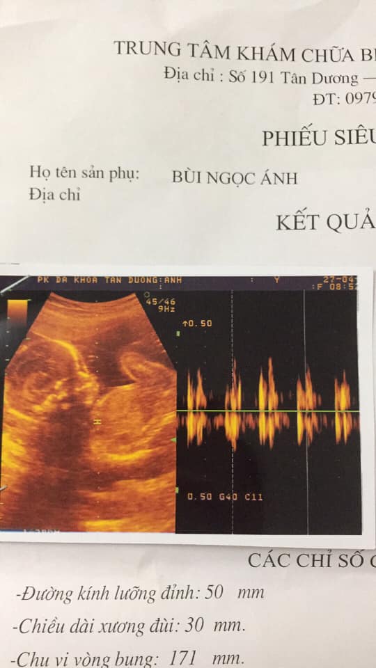 Các mom cho e hỏi zai hay gái đây ạ, lần trc e đi khám kết quả khác lần này kết quả khác e phân vân quá, e tập đầu