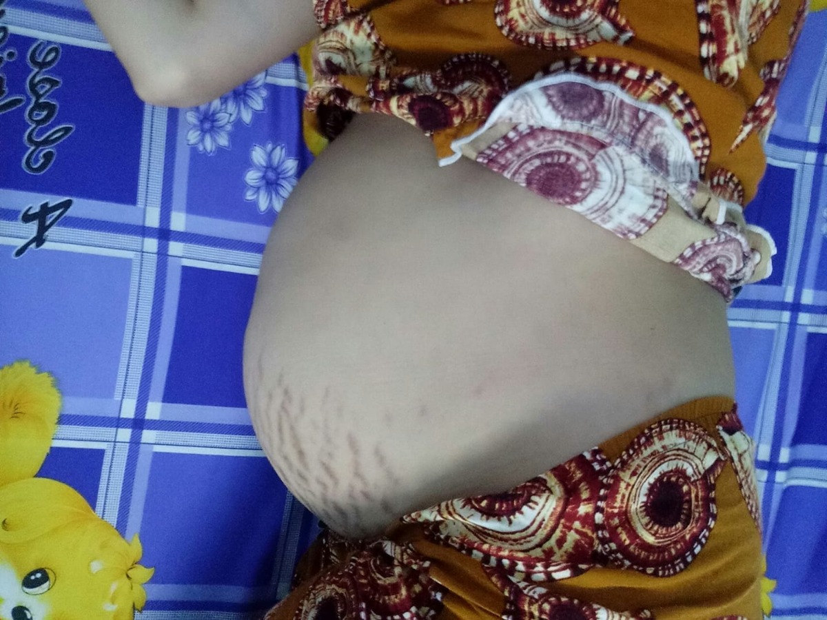 35t bụng gọn k mấy mom,rạn te tua hết rồi...