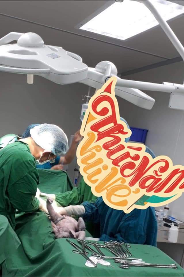Lại là e đây chào các M 
Trộm vía e đả sanh bé ra an toàn rồi ạ 
Bé sanh vào ngày 26/9
38w5day 
Bé nặng 3.500grm ạ 
Quá trình bắt bé ra đây ạ
