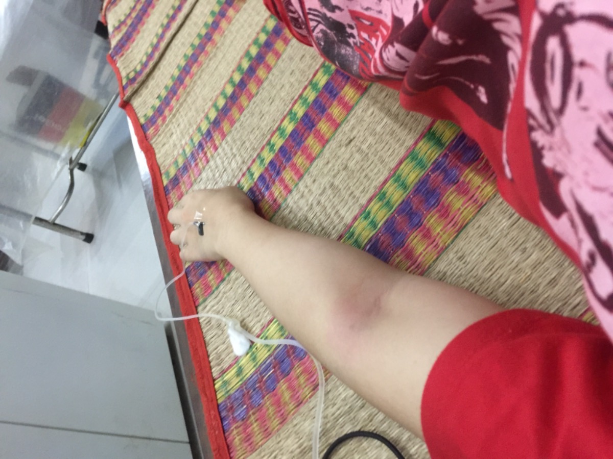 Bầu 10 tuần 4 ngày bị sốt nhiễm trùng có mom nào như em không chứ em buồn quá.Lo cho con mà em cứ nhức đầu ói miết thôi thảm lắm mấy mom à