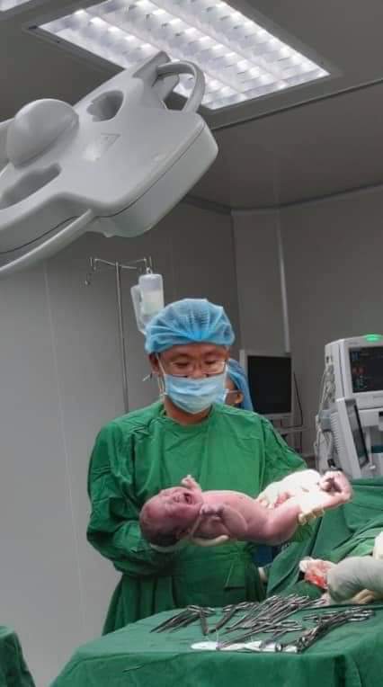 Lại là e đây chào các M 
Trộm vía e đả sanh bé ra an toàn rồi ạ 
Bé sanh vào ngày 26/9
38w5day 
Bé nặng 3.500grm ạ 
Quá trình bắt bé ra đây ạ