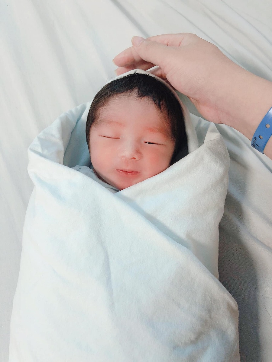 💉 Review đẻ mổ tại Bệnh viện Bưu Điện
Giờ em mới hồi phục sau khi đẻ mổ bạn Bun. Cũng không định review nhưng cuộc đi sinh lần này phải nói là kỷ niệm ly kì em không bao giờ quên 😂 Nên phải viết ra lưu lại để mấy năm nữa coi lại vẫn không quên vụ đi đẻ này 🤣
⚡️ Ban đầu em cũng tìm hiểu nhiều bệnh viện như BV Phụ sản HN (gần nhà), BV Thu Cúc, BV Việt Nhật,... Nhưng sau đó có chị ở chỗ làm khen BV Bưu điện có khoa sản khá tốt, sạch sẽ không chen chúc, mà giá cả lại hợp lý phải chăng, nhiều bác sỹ đỡ giỏi như bác Đồng, bác Hoa, bác Huyền,... nên em quyết định đẻ ở Bệnh viện này
⚡️ Làm hồ sơ sinh: Em làm hồ sơ sinh bao gồm xét nghiệm máu + nước tiểu + siêu âm ở Bệnh viện tại tuần thứ 32, tổng chi phí không có thẻ BHYT hết 1tr200k
⚡️ Dự kiến sinh của em là 18/7/2019, nhưng đến 5/7 có dấu hiệu nước ối giảm dần nên em quyết định sẽ đẻ mổ chủ động ngày 8/7. Ai dè tới tối 6/7, hai vợ chồng đang cố gắng chén nốt bữa hải sản để chuẩn bị lên thớt, thì cu Bun nhà em đòi chui ra. Thấy dấu hiệu như vỡ ối, em bảo chồng đưa vào Bệnh viện Bưu điện và lên thẳng phòng cấp cứu 302 trên tầng 3 luôn :))))) Thế là biết tan giấc mộng chọn ngày sinh đẹp các mẹ ạ 😭
⚡️ Nhập viện xong em mua phiếu khám, bác sỹ khám trong và đo monitor. Em bị rỉ ối, ối 4 góc còn có 40. Nên bác sỹ cho em nhập viện luôn. Bác sỹ bảo sẽ theo dõi cho đẻ thường, đẻ mổ là bất đắc dĩ mới nên mổ. Lúc ý em nhớ là 8h tối. Nhận áo bệnh nhân các kiểu con đà điểu xong em về phòng chờ đẻ. Ở phòng thấy các chị đang đau chuyển dạ la hét, khóc lóc trong khi mình chưa thấy bị đau gì, em vẫn còn cười phớ lớ tươi như hoa luôn 🤣
⚡️ Cứ ung dung như thế cho tới khi 4h sáng, em bắt đầu bị cơn đau chuyển dạ. Cấp độ tăng từ đau vừa tới đau thốn không tả được :))))) Cuộc đời 24 năm em chưa gặp cơn đau nào kinh khủng như thế. Đau mỗi lúc 1 dồn dập, 3 phút 1 cơn lại còn kéo dài 30 giây. Em đúng kiểu đêm cười phớ lớ sáng tắt nụ cười. Ôm lấy chồng mặt nhăn như khỉ rồi lăn lên lộn xuống. Ấy thế mà đi sang khám và đo tim thai vẫn chỉ mở ctc được 2 phân suốt 1 tiếng rưỡi 😭 Ui em đau phát điên mà em còn bị thiếu máu chứ, thế là cứ cơn đau lên lại đấm lão chồng thùm thụp :)))) Chả mấy khi có dịp trả thù mà 🤣
⚡️ Cơn đau đấy kinh khủng tới mức các bác ở phòng bảo em nên đi lại rồi dựa vào giường cho cố qua cơn để mở ctc cho nhanh, nhưng em thề là em đau tới tưởng chết luôn ạ. Mắt hoa hết cả đi, nôn ra mật xanh mật vàng. Em bảo chồng em phải sang xin bác sỹ cho mổ ngay. Chứ chờ tới khi ctc mở được 7-8 phân chắc em đi hẳn mọi người ạ 🙂 
⚡️ Bác sỹ mổ trong ca trực hôm ý là bác sỹ Việt. Bác bảo trường hợp của em vẫn đẻ thường được tại sao phải xin mổ làm gì. Nhưng em đau quá rồi như gẫy 20 cái xương sườn thật thì làm sao chịu được tiếp. Ui đau chuyển dạ thì đau bụng kinh nguyệt phải gọi là cụ luôn ý mọi người ạ 😂 Nó đau gấp 100 lần. Thấy em giỏi kêu đau với gào mồm nghe max mệt, thế là bác sỹ Việt bảo người nhà em kí cam kết mổ, xong bảo chị y tá cho em đo monitor lần nữa :)))) Trong 1 tiếng rưỡi chuyển dạ em cũng đo monitor đến 2 lần, khám trong thêm 2 lần nữa mà vẫn chỉ mở 2 phân ý. Nên nghe bác sỹ bắt đo monitor nữa em gào lên “Bác sỹ cho cháu đi mổ ngay đi ạ không cháu chết mất” 😂 Bác sỹ đến phát sợ với em về độ kêu đau nên bảo chị y tá đẩy em lên xe lăn, lăn sang phòng mổ vội =))))) Vụ này nghĩ lại em vẫn buồn cười. Sau này chị y tá sang phát thuốc cho em vẫn trêu là chính cái cô này kêu với bác sỹ không mổ cho cháu ngay thì cháu chết mất đây mà 😂🤣 Ngại thật sự haha, nhưng lúc đau đẻ quá thì em cũng chịu thôi không mổ gấp cho nhẹ người thì đi thật :)))))

💉 Vào phòng mổ: Ekip nhanh chóng đưa em vào phòng mổ, bác sỹ Việt trực tiếp đỡ cho em. Thực ra em nhờ bác sỹ Huyền 8/7 mới mổ chủ động cho em, nhưng ai dè lại chuyển dạ sớm nên không vào ca của bác Huyền ạ. Em nhanh chóng được tiêm gây tê màng cứng . Mọi người bảo tiêm tê mổ đau lắm nhưng lúc ý em tiếp tục phải chịu 2 cơn co chuyển dạ nên chả có cảm giác gì luôn 😤 Gây tê xong bác sỹ rạch 10 giây rồi báo em là đã lôi con ra rồi. Nhanh như 1 cơn gió luôn các mẹ ạ :)))) Sau đó em nghe con khóc oe oe, xúc động chảy nước mắt. Bác sỹ khâu độ 30 phút là xong. Nghe rõ tiếng chỉ khâu cứ bựt bựt, mà chả có cảm giác gì ahihiii. Một lát sau chị y tá bế con ra cho em nhìn, nhưng em bị cận nhìn chả rõ, chị ý đeo vòng tay định danh mẹ con rồi bế bé ra cho người nhà gặp.
💉 Sau mổ em được đưa vào phòng hậu phẫu theo dõi, tác dụng thuốc tê gây ngứa hết người, răng môi lẫn lộn run cầm cập, phải tiêm truyền chống run mấy lần. Nằm như thế 3 tiếng thì bác sĩ vào kiểm tra tử cung co có ổn không thì được về phòng. Đoạn này cũng thốn, vết mới mổ mà bác sỹ ấn sát mạnh xuống, đau không tả được luôn. Các mẹ chuẩn bị tinh thần là bị ấn ít nhất 2 lần cho ra sản dịch nhé 🤣

🏥 Sau khi về phòng, con được trả về với mẹ. Lúc này em mới mổ xong, cắm dây dợ, ống thông tiểu quanh người nên đau quá không ngoi nổi dậy nhìn mặt mũi con. Ngày đầu tiên em nằm viện là 7/7, y tá qua phát thuốc giảm đau nhét hậu môn gồm 3 viên. Tối tiêm 1 mũi giảm đau ở bắp đùi, ôi mũi này buốt thấu xương các mẹ nhé. Cứ xác định tinh thần là đau nhăn mặt luôn ạ 😂
🏥 Sau đó ngày 8/7 và 9/7, sáng có các chị điều dưỡng, hộ sinh lần lượt vào thay băng vết mổ, vệ sinh, thay bỉm cho mẹ, bế con đi tắm. Bác sỹ nhi tới từng phòng khám cho các bé. Bệnh viện có chiếu tia plasma sau mổ, không đau tý nào luôn mà vết mổ khô nhanh với đẹp lắm ạ. Hôm nay em mổ được 4 ngày mà đã khô rồi không bị kiểu lồi lõm, lem nhem. Bác sỹ dặn đến ngày thứ 2 nằm viện là phải cố dậy đi lại, và phải xì hơi được để lấy lại sức khoẻ nhanh. Trộm vía gì chứ khoản đi lại sau mổ, với vụ oánh hơi kia thì em làm tốt, oánh hẳn mấy quả luôn 🤣
🏥 Em chém tý cho vui thế thôi, chứ để nhấc được người đứng lên hay nằm xuống cũng đau lắm ạ. Vì bị gập vết mổ ở bụng ý mà. Lúc đau quá em nhét thuốc hậu môn thì lại đi được bon bon. Mấy chị cùng phòng còn phải bảo em tự ngồi dậy được không cần ai đỡ là quá khoẻ 😂 Nhưng có người đỡ còn đau hơn. Tự lết lết ngồi dậy nằm xuống cho nhanh với quen các mẹ ạ. 
🏥 Ở viện buổi tối mỗi sản phụ có tiêu chuẩn được thuê 1 giường gấp giá 10k cho người nhà ở lại chăm. Nhưng mẹ em với mẹ chồng em ở lại đêm chăm cháu, cứ 2 tiếng pha sữa cho cu Bun nhà em một lần nên các bà cũng chả ngủ được. Phần vì các bé khác khóc quấy cả đêm nữa. Đúng là 3 ngày 2 đêm không được ngủ đủ giấc giây nào. May cu Bun nhà em không khóc đêm ngằn ngặt và không quấy. Trộm vía. 
🏥 Dịch vụ ở viện: Em đăng ký làm xét nghiệm lấy máu gót chân cho Bun nhà em, tổng 3 bệnh hết 600k. Ngoài ra nếu có nhu cầu tắm bé, thông tia sữa thì các chị hộ sinh, y tá cũng sẽ tới tận nhà làm cho mình. Nói chung em thấy dịch vụ ở Bưu điện rất oke, mặc dù không phải là Bệnh viện tuyến đầu như Phụ sản nhưng quy trình sinh nở, chăm sóc sau đó quá là chặt chẽ tuyệt vời luôn.
🏥 Chi phí ra viện: Em không có thẻ BHYT (thẻ của em đúng 1/7/2019 lại hết hạn mới đau) nên không được giảm đồng nào. Hôm nhập viện chồng em cọc 10tr800k, lúc ra viện tổng hết 9tr800k. Tính cả tiền nhà em cảm ơn bác sỹ kíp mổ đẻ 3 triệu, và tiền làm hồ sơ sinh với mấy khoản phát sinh linh tinh như đo monitor, siêu âm 2D, thì chi phí đi sinh tại Bệnh viện Bưu điện của em là 15 triệu đồng.

🍎 Nhận xét: Em rất hài lòng với lần đi sinh này. Bệnh viện Bưu điện có đội ngũ bác sỹ sản rất mát tay. Phòng ốc sạch sẽ, điều hoà bật kín từ hành lang tới lối vào, không lo bị nóng luôn ạ :)) Đẻ xong về phòng bác sỹ mổ cho mình còn qua thăm khám hỏi tình hình, nói chung là rất quan tâm bệnh nhân haha. Mặc dù em hơi tiếc vì không được bác sỹ Huyền mổ, nhưng bác sỹ Việt của kíp mổ hôm đó khâu cho em rất đẹp luôn. Em hoàn toàn hài lòng. Bác lúc đầu có hơi khó tính vì em còn gắt lên với cả bác sỹ ý vì đau ý nhưng thôi sau khi được mổ thì em hài lòng 100% luôn :)))) Bác sỹ Huyền thì gọi hỏi em ở phòng nào qua thăm nhưng em không để ý điện thoại nên về rồi mới biết. Nói chung các bác sỹ tâm lý và các chị điều dưỡng cũng rất oke 😬 Cơ địa em liền nhanh nên về nhà vết mổ không đau mấy, bụng dạ lại sắp thon gọn như con gái rồi, em chưa thấy bị xồ xề gì cả ý. Có vấn nạn sữa không về nhiều sau mổ thì bây giờ cũng giải quyết được rồi. Ngực bây giờ lúc nào cũng full căng sữa, con không ti cho thì nặng nề thôi rồi. Sau vụ này khéo size ngực em nhảy lên 100 mất các mẹ ạ :))))

❤️ Mặc dù so với các Bệnh viện sịn sò về khoa sản như Vinmec, Việt Pháp, BV Bưu điện không bằng ở cơ sở vật chất hay thiết bị. Nhưng với chi phí sinh đẻ giá bình dân hợp lý thì các mẹ cứ yên tâm mà chọn Bưu Điện ạ. Đây là do em không có BHYT, chứ có thì em được giá đi đẻ rẻ hơn nhiều. Bảng giá đi sinh em up của em này là đã full đủ dịch vụ nha các mẹ. Khá ổn ạ 😃
Em hài lòng khi đăng ký sinh ở Bưu điện. Lúc viết bài này là em đang ôm con cho con bú đây 😂 Lâu lắm mới có hứng viết văn vẻ dài dòng thế này ý ạ. Các mẹ sắp đẻ có thể lựa chọn giống em, em tin là mọi người không thất vọng đâu 😆