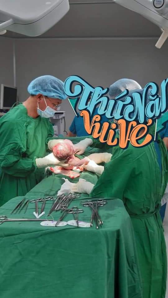 Lại là e đây chào các M 
Trộm vía e đả sanh bé ra an toàn rồi ạ 
Bé sanh vào ngày 26/9
38w5day 
Bé nặng 3.500grm ạ 
Quá trình bắt bé ra đây ạ
