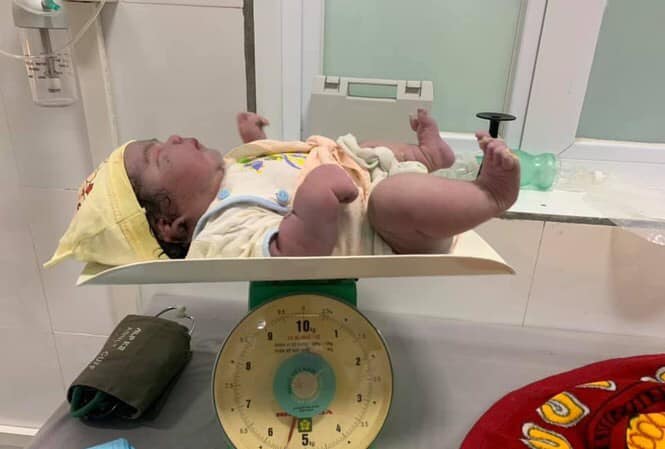 3,6kg với t đã hú hét thấy cụ nội rồi ( xin mổ mà éo cho) . T nể thím này quá các mày ớiiiii😎

Kỳ tích sản phụ sinh thường bé gái nặng 5,5kg tại huyện miền núi Nghệ An 😳😳😳

Các bác sỹ khoa Sản ở huyện miền núi Tân Kỳ (Nghệ An) đã đỡ thành công cho sản phụ H., bé gái nặng 5,5kg chào đời trong niềm vui của gia đình và y bác sỹ.

Ngày 20/10, thông tin từ Trung tâm y tế huyện Tân Kỳ (Nghệ An) cho biết, Trung tâm vừa đỡ đẻ thành công cho sản phụ Nguyễn Thị H. (33 tuổi, trú tại xã Nghĩa Đồng, huyện Tân Kỳ). Chị H. sinh thường bé gái nặng 5,5kg.

Theo bác sĩ Giản Viết Hợp - Khoa sản, Trung tâm y tế huyện Tân Kỳ thông tin, sản phụ H. mang thai con thứ 3 với 38 tuần 5 ngày tiền căn sinh con to. Sau khi thăm khám, các bác sỹ đã quyết định cho sản phụ sinh thường. Đến 4h45 phút (ngày 20/10), kíp trực đã đỡ đẻ thành công cho sản phụ, bé gái nặng 5,5kg chào đời trong niềm vui gia đình và y bác sỹ tại Trung tâm.

“Đối với những trường hợp sinh thai lớn thì sản phụ rất dễ bị những di chứng như băng huyết, rách phần mềm phức tạp thậm chí vỡ tử cung, thai nhi cũng rất dễ bị tổn thương”, bác sỹ Giản Viết Hợp cho biết thêm.

Được biết, đây là lần sinh nở thứ 3 của sản phụ này. Lần sinh thứ hai, chị H. sinh được một bé nặng 4,8 kg, bé đầu nặng 3,8 kg đều sinh thường. Quá trình mang bầu bé thứ 3, người phụ nữ ăn chủ yếu trái cây và các loại ngũ cốc bổ dưỡng, cân nặng chỉ tăng khoảng 11 kg nhưng bé thứ 3 lại nặng tới 5,5 kg.

Nguồn tin: tienphong.vn