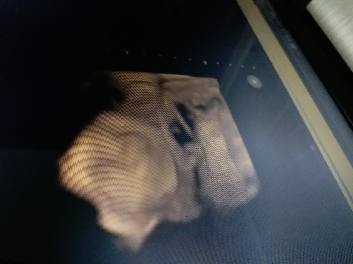 Bé nhà mình đc 24w nặng 623g . Mẹ bé tăng 2 kí ạk .. hình chụp siêu âm nhìn rỏ ko các mom sao mình đưa ck xem mà ck bảo ko thấy rỏ