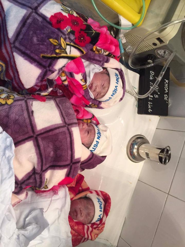 Từ đợt biết em chửa ba 👶🏻👶🏻👶🏻 là an ủi may mắn có rất nhiều bạn bè người thân cũng như cả những người lạ chưa quen vào hỏi han quan tâm về cảm nhận của em cũng như quá trình em mang thai như thế nào vì đây cũng được coi là trường hợp hiếm gặp.

Em xin chia sẻ là em Mang thai 3 tự nhiên ạ và đều là 3 bé trai, 2 bé cùng trứng 1 bé khác trứng. Nhưng nhìn chung 3 bé vẫn giống nhau nhưng vẫn có nét riêng để bố mẹ phân biệt. Vì sao em lại may mắn có thai 3 tự nhiên? Theo như em được bác sĩ giải thích là vì cơ thể em có buồng trứng đa nang (nang nước) nên dễ rụng trứng chùm và cũng do chồng em nữa ạ.
Lúc thai làm tổ được 5 tuần là em đã đi siêu âm rồi và bác sĩ có khuyên em nên giảm thiểu phôi thai vì giữ cả 3 lại thì sẽ rất khó. Hơn nữa đa thai thì sẽ có nhiều nguy cơ như là : dị tật, sinh non,.. Nghe cũng hoang mang và đắn đo vì thực sự có phải ai cũng được đa thai tự nhiên đâu. Rồi em lại sang tiếp 1 bệnh viện QTe cũng khá nổi tiếng ở HN để ktra lại. Ở đây bsi cũng kết luận em nên giảm thiểu phôi thai : 1 là phôi đơn ,2 là phôi thai đôi. Tuy nhiên cả 2 phôi thai lại đều có nguy cơ : phôi thai đôi tức là gồm 2 bé thì sẽ rất dễ bị dính nhau, hoặc sẽ bị truyền máu sang nhau tức là bé này sẽ hấp thụ hết của bé kia, tăng trưởng ko đồng đều hoặc có khi chỉ có 1 bé phát triển được. Còn phôi thai đơn thì nước ối ít, sợ em bé sống trong đó ko được nuôi dưỡng khoẻ mạnh,,.. Em siêu âm đầu dò và khám 3 lần trong 3 tuần liền 7,8,9 thì bác sĩ vẫn khuyên em nên giảm thiểu 1 phôi thai đi. Nhưng em thực sự đắn đo vì nghĩ các em đều đến với mình, sao nỡ bỏ em nào dù thực sự những nguy cơ bác sĩ vạch ra cực kỳ nguy hiểm và tiêu cực. Sau vài tuần chần chừ thì em cũng quyết định chuẩn bị giảm thiểu phôi thai tại Bv đó vì nếu để quá 10 tuần sẽ ko can thiệp được nữa. Giấy tờ làm xong cả rồi , lịch hẹn sáng mai cũng đã lên. Thế mà rồi về nhà, em bàn với chồng em và mẹ em. Ai cũng có vẻ muốn giữ. Nhưng chồng em cũng sợ nếu giữ thai 3 nguy hiểm cho em khi mang thai nên cũng nước đôi. Còn mẹ e thì bảo e nhờ người quen làm trong viện hỏi xem có chỗ nào bác sĩ giỏi ko để khám lại cho chắc, xem có giữ được không vì tâm lý bà thích đông cháu.
May làm sao em lại có bà chị của bạn thân làm ở Sản TW , nhờ chị giới thiệu cho khám ở 1 bác sĩ C rất nổi tiếng ạ. Mẹ nào bầu hay đẻ rồi chắc cũng biết ( ai có nhu cầu mà chưa biết thì có thể inb e chỉ cho 😂) . Khám cho em bác mắng xơi xơi luôn vì sao lại giữ cả 3 thế này , nguy hiểm quá. Nguy cả cho mẹ cả cho con ạ. Vì thai ba thế này thường chỉ đến tầm tuần 20-22 là rất dễ sảy thai, động thai. Nhưng khổ nỗi sau khi khám cho em xong, bác nhăn mặt bảo " Giờ ko giảm thiểu cũng dở mà giảm thiểu càng dở, động vào chỉ có tạch hết".. E hoang mang hỏi sao lại thế ạ thì bác chỉ, hiện giờ 2 phôi ở quá sát nhau, giảm cái này ảnh hưởng cái kia, giờ làm thì hỏng cả chùm luôn. Có làm hay ko thì tự em phải quyết định. Em tin bác có kinh nghiệm nhìn nhận nên đánh liều hỏi e có nên giữ lại ko, dù bác nổi tiếng khó tính ý ạ. Thì e thấy mặt bác có vẻ cũng bình thường, bảo là " thôi thì ý trời"..

Ko biết có phải do thái độ bình thản của bác ko mà cho e niềm tin em nên giữ lại. Vì e nghĩ với 1 bác sĩ chuyên môn như vậy mà thấy bất ổn thì họ sẽ khuyên mình luôn là bỏ đi. Vậy là với sự động viên của gia đình em đã quyết tâm ko giảm thiểu, giữ cả 3 em bé lại. Dù cho trong cả quá trình em mang bầu, ko 1 ai là ko lo các yếu tố rủi ro khi mang đa thai như e đã liệt kê, nhưng chẳng ai dám tỏ ra lo lắng cả.

Còn về phần e thì e nói thật, e luôn cố gắng giữ tâm trạng cực kỳ vui vẻ, không nghĩ đến liệu con mình có bị nguy cơ này nguy cơ kia ko, cứ thế cố gắng từng ngày từng ngày giữ cho cơ thể thật tốt để chống chọi với mọi biến cố có thể xảy ra bất kỳ lúc nào.
Ba tháng đầu em nghén kinh khủng, ko ăn được bất cứ thứ gì luôn, ăn là nôn, chủ yếu là uống đầy đủ các loại thuốc bổ thai :
- Bio island DHA
- Chela Ferr
- Elevit
Qua tháng thứ 4 trở ra thì e có uống thêm Canxi nữa vì nếu ko bổ sung canxi thì mẹ bầu sẽ rất dễ bị chuột rút. Và 1 mẹo là khi bị chuột rút, các mẹ hãy bẻ ngược bàn chân ra phía trước, giữ 1 lúc là hết. Lúc này thì e đỡ nghén rồi, bụng cũng bắt đầu to lên rõ 1 xíu.
Qua tới tháng thứ 5 , bụng e phát triển nhanh kinh khủng dù ở người chửa 1 thì phải 7 tháng trở ra mới thấy thay đổi nhiều.
Qua đến tháng thứ 6 là nhìn em đã rất ì ạch rồi, nhất là vấn đề thở cực kỳ khó khăn, tim đập nhanh , lúc nào cũng thình thịch như vừa chạy marathon í. Ba em bé 2 em nằm ngược 1 nằm xuôi đạp liên tục ko ngơi nghỉ ngày đêm 😂 vì em này nghỉ lại đến em kia đạp ý ạ . Lúc trồi khu này lúc lồi khu kia, bụng méo xẹo méo xọ
Từ tuần 18-22 là phải đi kiểm tra tiểu đường thai kỳ. Đây quả thực là 1 cực hình í ạ. Em kiểm tra ở BV Lão khoa Trung ương ở Phương Mai, chỗ này ổn, sạch sẽ. Trước ngày đi kiểm tra em phải nhịn đói 8-10 tiếng , đến uống 1 cốc nước đường đặc lạnh ngắt. Giữ được khoảng 30' thì mắt em hoa, chân tay bủn rủn , nhìn từ màu xanh sang đỏ xong đen, người em xìu xuống may có chồng đi cùng, xong em phun hết ra sàn bệnh viện ☹️ ngại ghê. Nhưng toàn nước đường thôi làm gì có gì đâu. Em ko biết có phải mình em bị khó khăn với việc kiểm tra tiểu đường này ko. Phải đến 3 tuần sau đi ktra lại em cố gắng ngồi thở đều 1 tiếng đầu để không bị nôn mới có thể vượt qua được. Phù. Đến tuần 28 lại đi ktra lần nữa để chuẩn bị tiêm trợ phổi cho các em bé. Cái này cực kỳ quan trọng với các mẹ có nguy cơ sinh non vì hỗ trợ rất nhiều cho hô hấp của các em. Nhiều mẹ chủ quan ko tiêm, bị sinh non mà phổi chưa phát triển nên ko giữ được bé đó ạ ☹️
Rất may mắn là em đã qua được tuần nguy hiểm là từ 20-25 tuần vì rất dễ doạ sảy rồi có khi phải vào nằm viện từ tuần 20 đến lúc đẻ í ạ 🙄
Từ sau 28 tuần trở ra là em đã siêu ì ạch, khó thở, đùi teo mông tóp như kiểu các em bé lấy hết chất ding dưỡng của mình í, trvia ăn bao nhiêu vào các em hết. Bụng e nhìn buồn cười lắm 😂 như kiểu khối vuông khổng lồ í 😆 mấy tuần cuối trước khi mổ, bụng em lúc nào cũng căng rạn như sắp bục í. Chồg e sợ vợ ko chịu được cứ giục em hay đi xem thế nào xin bác sĩ mổ đi.. thế có hâm ko 😂 trong khi nta phải cố giữ được tuần nào tốt tuần í..
Và rồi cũng đến ngày em đi đẻ..
Mọi việc diễn ra siêu nhanh chóng ko thể lường được chỉ vì e nghi ngờ nhầm bị rò ối huuhu
Và lúc đó là e mang thai được 31 tuần 5 ngày 👍🏻

..........
23/06/2017
Hôm đi đẻ sợ thực sự í ạ vì tâm lý chưa chuẩn bị gì .. Đêm hôm trước bụng e cứng đơ đờ đờ, hai bên thành bụng căng cứng hình khối vuông luôn. Cả đêm e trằn trọc ko ngủ nổi vì khó thở, thở gấp tim đập nhanh.. ngồi thì còn đỡ chứ vừa ngả lưng 1 cái là mấy đứa nó như kiểu rướn ko thích í huu làm mình vừa đau vừa tức. Hai bên mạn sườn cảm tưởng như sắp bung ra đến nơi 😂.. Xong, sáng sớm 5h hai vc đã lục đục dậy đi ăn sáng để chuẩn bị sang viện khám rồi có gì xin nhập viện nằm luôn theo dõi vì cũng gần vào tuân 32 tuần gần đẻ r,,. Ăn phở chán chê ở Hàng Da đến tận gần 8h mới nhấc máy lên gọi cho chị H để hỏi giờ em đến viện đã mở cửa chưa chị 😂 chị bảo ôi nghi ngờ rỉ ối thì đến luôn chứ e viện lv lâu rồi mà. Lại ba chân bốn cẳng ì ạch vào luôn khoa cấp cứu.
Em đến một phát, miêu tả tình hình thì được mấy chị y tá cho lên nằm cái giường giống giường đẻ mà bạnh 2 chân ra để chờ bác sĩ vào kiểm tra í. Lúc í e vẫn bình tĩnh lắm, nằm luôn ko căng thẳng gì vì tâm lý cũng nghĩ nta ktra rồi cho nhập viện. Bụng e lúc í thì siêu to rồi nên nằm ngửa có 10 phút thôi mà đau tê tái 2 bên sườn lẫn khó thở . Chờ 1 lúc sau thì có 2 bác sĩ đến kiểm tra và các bác đều kết luận e mở 2 phân rồi chuẩn bị mổ cấp cứu thôi dù ối chưa vỡ và chưa xuất hiện cơn co 😳 nghe đến quả chuẩn bị bàn 15' nữa mổ cấp cứu mà thề 2 răng em tự nhiên cứ bập vào nhau, người rét run lên từng cơn , nhất là quả chân cứ thể chập vào nhau liên hồi nhìn đến khổ ☹️ ko hiểu sao lúc í lại run bần bật lên như thế.. có thể do mình chưa chuẩn bị tâm lý là hôm nay mình sẽ phải mổ nên thành ra oằn tà là vằn như vậy 😂.. sau khi có lệnh thế rồi thì chị y tá đo nhịp tim để xác định vị trí của 3 em ở đâu xong đánh dấu "X" lên 3 điểm : 2 ngôi ngược 1 ngôi xuôi. Cái này thì siêu âm lần nào bác sĩ cũng nói nên e cũng biết rồi hehe . Rồi em được ngồi vào xe đẩy để chuẩn bị đẩy lên phòng mổ.
Trước lúc lên thì chị y tá kêu em đặt nhanh tên cho 3 bé , đặt tên gì cũng được để họ ghi hồ sơ í. Mà quả thực tâm trạng lúc đấy của em đang siêu hoảng loạn nên e bập bẹ thế nào ra 3 quả tên : Nam , Tú với cả Sơn 😂 chồng e sau có hỏi sao e lại đọc thế dù trước đấy bàn tên con rồi .. ôi giời lúc í run lên run xuống thở ko ra hơi thì tâm trí đâu mà nhớ nổi.. Thế rồi em được đẩy lên thang máy đi lên tầng mổ, trên đường đi lên e có được gặp chồng , lúc í chỉ có mỗi chồng e và bố chồng vừa đến thôi vì mọi việc được chỉ định nhanh quá mọi người chưa kịp tới. Nhìn mặt chồng em cười hớn ha hớn hở mà nước mắt em cứ trào ra ko phải vì cảm động gì đâu mà vì em sợ quá í 😂 cảm giác nghĩ mình sắp bị " banh thịt" thực sự rất thốn luôn..
Cái quãng đường đến phòng mổ sao mà lại gần đến thế.. em cứ mong nó xa xa để em kịp định thần lại cho đỡ hoảng... à mà trước khi vào phòng thì em có nghe lén được là em sẽ được mổ ở phòng gần cửa kính người thân sẽ được đứng đó nhìn nên tâm lý cũng thấy đỡ đỡ sợ.. nhưng đến lúc vào thì nhìn quanh em thấy mọi ô cửa đều bịt kín nên hoang mang cực kỳ.. đúng lúc í thì có người kêu em nằm lên bàn đi, em chỉ thấy khoảng chục người mặc đồ xanh đang đi ngược đi xuôi trong phòng thôi nên cũng ko biết ai với ai bảo gì thì làm nấy thôi.. Thế rồi cũng những bước đi run rẩy đã đưa e lên bàn đẻ.. cảm gíac này chị em nào đi đẻ lần đầu chắc mới hiểu nó đơ đến mức nào huhu.. Nằm ngon lành rồi thì bỗng toàn cơ thể em rét run lên, rét thực sự í ạ, em cảm nhận được tay chân như đóng băng, 2 răng bập vào nhau liên tục đến nỗi khó có thể nói được .. mấy bác mấy chị thấy em cứ rét run lên thì hỏi " em lạnh à để tắt điều hoà ?". Em đồng ý ngay nhưng sau đó em vẫn run ko ngừng :)) cảm giác ko thể làm chủ được cơn run kèm theo 2 hàng nước mắt cứ chảy vì sợ hãi, sợ cảm giác nằm trơ vơ một mình giữa căn phòng phẫu thuật đầy mùi sát khuẩn và tiếng leng keng của dao kéo . Mắt em nhèo nhoẹt nhìn theo từng người đang chuẩn bị trong phòng. Rồi bỗng 1 người nam ko hiểu bác sĩ hay y tá nhưng nghe giọng trẻ trẻ bảo em là
- " Banh 2 chân ra đi em"..
Lúc ý em bối rối quá em mới bảo là
- " Ơ anh ơi em đẻ mổ ạ không phải đẻ thường đâu ạ" 😂
Thế là anh ý gằn giọng " chị này hay nhờ banh ra để tôi đút ống thông tiểu vào ",,hết hồn😆.. nhưng lúc ý e cũng ko hiểu thông ống tiểu là kiểu gì nên e cũng run vì dù sao cũng động vào bộ phận nhạy cảm , em đã cố lắm để mở hai chân ra mà càng banh càng ríu 🤣 cứ bập bập như hai môi bập vào nhau í mãi ko mở ra được. Xong em cũng sợ cứ lâu la bị mắng nên cố dùng hết sức bình sinh để chạng được đôi chân ra. Hoá ra thông ống tiểu cũng không có gì đau đớn như em tưởng, chỉ nhói nhẹ 1 cái thôi là xong hehe.
Tiếp mới đến đoạn ngu. Ngu ở chỗ trước hôm đi đẻ em lại lỡ xem cái clip " Quy trình gây tê màng cứng" nên em biết bác sĩ sắp làm gì em. Đầu tiên là nằm nghiêng, xong co người như con tôm, tay giữ lấy đầu gối, giữ nguyên vị trí như thế thôi là xong, việc sau đó để bác sĩ lo. Đấy, giá như em chưa xem cái clip đấy thì em sẽ không biết là tiếp đó sau lưng mình bác sĩ sẽ cắm 1 quả kim tiêm siêu dài vào sâu trong xương của mình rồi bơm thuốc tê vào thì em sẽ đỡ sợ biết bao nhiêu. Vì biết trước là ngta sắp làm gì sau lưng mình nên lưng em theo phản sợ sợ hãi ko thể hợp tác cong nổi 🤣 bác sĩ vừa chạm tay vào chưa kịp làm gì em đã ưỡn ra rồi. Phải 3 , 4 lần em bị phản xạ rụt người lại thì em cố gắng ôm ghì lấy chân mình, nhắm mắt đầu lẩm nhẩm " rồi mọi chuyện sẽ ổn, rồi mọi chuyện sẽ ổn" để tĩnh tâm ( câu này em học trong phim "3 Idiots" có hiệu nghiệm phết hay rảnh xem đi hay lắm 😂 ) . Bắt đầu e thấy có 1 sự nhói nhẹ ở sau lưng, rồi cảm giác ê ê buốt buốt chạy dọc sống lưng rồi bắt đầu em ko thấy đau nữa.. 1 lúc sau em được đặt nằm ngửa . Lúc này bác sĩ kêu em nhấc chân phải lên rồi chân trái lên, em đều không nhấc được, cả 2 chân đều ko có cảm giác gì. Thế là em tự hiểu thuốc đã ngấm rồi vì em chuẩn bị bị mổ huu. Lúc này thì đỡ vơi bớt sợ rồi vì nghĩ sẽ ko bị đau nữa và cũng háo hức vì sắp được gặp 3 em bé .
Em được che 1 cái màn màu xanh đậm ngay trước ngực, tức là ko nhìn thấy phần bụng mình đâu. Em được thoa thuốc sát trùng vì ngửi mùi là em biết, thoa rất nhiều luôn. Rồi em thấy hơi nhói ở phía dưới bụng dưới và nghe tiếng đúng kiểu như tiếng rạch cá í ạ. Em cảm nhận được rõ là em đang bị rạch bụng luôn dù ko đau gì cả nhưng vẫn biết. Khoảng 5 phút sau , em thấy như kiểu bác sĩ thò hẳn tay vào bụng em í ạ, xong móc móc lôi ra rồi hô " 1 chú đây rồi " kèm theo tiếng khóc " Oe Oe Oe" đầy non nớt. Tự nhiên lúc đó e thấy bụng e nhẹ bớt ko còn căng căng nữa và nước mắt thì cứ thế trào ra, em cười không ngừng, vừa cười vừa khóc..
2 phút sau, lại 1 chú được "móc" ra rồi tiếp lại em bé còn lại được "moi" ra nốt sau 2 phút kèm theo tiếng "oe Oe Oe" ầm cả phòng.. Lúc í em cảm thấy bụng nhẹ dã man . Các bé được bế đi cân luôn , chị y tá thông báo cả 3 em mỗi e 1 cân 6 .. rồi bế lướt lướt từng bé ra cho em nhìn . Thấy 3 em bé mặt đỏ gay gắt bé tí tẹo được quấn trong chăn em cảm thấy hạnh phúc lắm , như kiểu mình vừa lập được đại công ý ✌🏻😆
Sau đấy chỉ còn lại em và ekip khâu thôi, có 2 bác đứng khâu cho em cùng mấy chiu y tá vui tính hỏi chuyện em xoay quanh chuyện chửa 3 em bé vất vả này kia. Lúc sinh xog cũng là tầm 9h20 rồi thì phải hơn 10h em mới được ra phòg hồi sức . Nằm ở phòng hồi sức một mình 3 tiếng liền. Trong 3 tiếng đó chỉ chờ từng phút một được gặp chồng , gặp bố mẹ , người thân để kể lể hết ra những gì em đã trải qua. Nhưng đã thoát đâu. Không hiểu do tác dụng phụ của thuốc gây tê hay gì mà em nằm trong phòng hồi sức mà run ko thể kiểm soát nổi , người cứ giật bần bật, em được truyền thuốc cho đỡ rồi mà cứ thế run nên lại càng mất sức và lả.. người cứ rung lên ko tự chủ, vừa sợ vừa buồn vì nằm 1 mình , xung quanh cũng toàn mấy chị mấy mẹ vừa đẻ xong đang nằm thiu thiu.
Thế nên mấy anh chồng ở ngoài ngóng vợ thế nào thì cũng ko thể bằng các chị em nằm bên trong ngóng được ra ngoài gặp người thân đâu ạ. Lúc được đẩy ra ngoài nhìn thấy mẹ và chồng đang đứng chờ ở gần thang máy, em chỉ muốn tuôn hết ra 1 tràng cảm xúc của mình từ lúc bị cách ly đến giờ..
Sau đấy em được nằm theo dõi ở viện 5 ngày, 3 em bé thì nằm riêng trong phòng hồi sức , hơn 10 ngày sau mẹ con mới được gặp nhau. Thực sự gian nan nhưng quả thực xứng đáng. Dù lúc mang bầu có vất vả cỡ nào mà ra 1 phát 3 em thế này để bận việc suốt ngày , em cũng nhìn vào để an ủi mình phải cố gắng, thật cố gắng vì các em ❤️

-------//-------

Chăm con cả đêm bây giờ mới mó vào máy thì em lại nhận được kha khá các câu hỏi của các bạn các chị về vấn đề Buồng trứng đa nang (BTĐN) ạ
Vì nhiều người thắc mắc sao BTĐT vẫn có khả năng có con thì e xin giải đáp theo trường hợp của em
Thực sự trước đây từ khi còn con gái , chính xác là từ khi dậy thì thì kinh nguyệt e hoàn toàn ko đều, 1 năm số lần có kinh chỉ đếm trên đầu ngón tay thôi - chắc được 3-4 lần/năm là căng, cách nhau cứ 3-4 tháng 1 lần. Tình trạng cứ thế kéo dài từ lớp 8 đến tận lớp 10. Mẹ e cho e đi khám, siêu âm đủ kiểu thì bác sĩ kết luận e bị " U nang nước " và BTĐN , khả năng sau có con rất thấp, chỉ 50/50 thôi. Hồi đấy còn nhỏ nhưng nghe cũng hoảng chứ. Mẹ e cho em uống đủ loại thuốc từ tây đến tàu , cứ nghe đâu mách hay là khám ở đó rồi lại thuốc thang. E nhớ có lần e ra khám ở Đê La Thành, được cắt cho mấy chục thang thuốc bắc. Ngày uống 2 túi sắc sẵn. Cứ liên tục 2 tháng đều đặn. Mà e vẫn nhớ như in cảm giác uống vào là say nhưng e vẫn cố gắng để điều trị đều kinh. Nhưng vẫn vô ích. Sau bao lần kinh nguyệt vẫn loạn xị, vẫn thưa , ko đều. E cũng nản và để kệ. Đến năm 2014 em có đi khám lại ở 1 phòng khám chuyên khoa phụ khoa, kết quả vẫn vậy và thậm chí tỉ lệ còn thấp hơn. Bác sĩ có cảnh báo nếu trước 22 tuổi em ko thể có con thì tỉ lệ sau này có quả thực sẽ rất thấp. Em cũng ko biết số tuổi ảnh hưởng gì đến khả năng thụ thai vì những vấn đề này thuộc về bên chuyên môn. Nhưng nghe thế thì cũng rén. Vì lúc đó e đã 20t r ( e sinh năm 1994) và e cũng ko có ý định kết hôn trước năm 22 tuổi. Sau đấy em cũng để kệ ko điều trị gì thêm và e cũng nói rõ vấn đề này với ny e- cũng chính là chồng bây giờ của em 😂
Thì anh có nói không sao cả, e ko có con thì sau mình nhận con nuôi. Dạ vâng mồm nói thế mà đùng 1 phát ông ý " lừa " e , "thả" ko để e biết ( như thế nào thì e ko tiện nói kỹ ). Đến lúc có bầu e cũng đau biết đâu.
Chỉ nhớ lúc í là tầm tháng 11 năm ngoái, bụng e đau râm ran như kiểu đến kỳ, thậm chí đau hơn. E cũng nghĩ chắc e sắp bị vì lâu lắm chưa bị. Nhưng thường nếu đau bụng kinh thì chỉ đau khoảng 5 ngày là hết và có kinh. Nhưng 2 tuần trôi qua rồi mà vẫn chưa thấy. Bụng e đau đến mức quằn quại ngất lên ngất xuống. E có uống cả thuốc Dolfenal để giảm đau bụng kinh ( may ko ảnh hưởng đến các bé ) . Uống 4 viên liền. Nhưng cũng ko hết. Nghi nghi thế nào e mới bắt chồng - lúc í vẫn là ny 😆 đi mua que thử và thấy 2 vạch 😨. Tâm trạng của e lúc í cực kỳ hỏang loạn chứ đừng nói vui mừng vì mình đã có con. Vì gia đình e vốn rất nghiêm khắc, e quen ny e nhưng cũng chỉ nhận là bạn chứ đâu dám công khai. Nên nghĩ giờ mà nói e có bầu chắc bị tống cổ ra khỏi nhà mất. Chả bù cho ông chồng e lúc đấy cười ngoác cả mồm mà thực sự mãi sau e mới biết quy trình e bị "gài" thế nào để có 3 thiên thần nhỏ đáng yêu như bây giờ - hoàn toàn bất ngờ luôn ạ.

VẬY - CHỐT LẠI LÀ GÌ?
E nghĩ cái gì mà mình ko nghĩ đến thì nó sẽ đến, cái gì cứ mong ngóng thì mãi chẳng thấy đâu. Việc này hoàn toàn thuộc về mặt tâm lý ạ, mọi người mong muốn có con đừng nên quá gò bó tâm lý là phải có như thế nào, bằng cách nào. Hãy để mọi thứ tự nhiên, cả 2 giữ tâm trạng thoải mái thì e nghĩ tỉ lệ thành công sẽ cao. Và yếu tố bất ngờ cũng góp phần trong đấy đấy ạ 😂.

-----------///-----------
TIẾP ĐẾN
E thấy nhiều người mang bầu uống rất nhiều nước dừa nước mía để mong con sạch con trắng nhé. Điều này thì trước khi e mang bầu và cả trong giai đoạn đầu mang bầu e cũng nghĩ thế. Vậy nhưng hoàn toàn ko hẳn thế đâu ạ.
Việc các mẹ hấp thụ quá nhiều nước dừa nước mía sẽ gây ra tình trạng dư thừa ối, hơn nữa sẽ làm tăng lượng đường trong máu, dễ gây ra tình trạng bị DƯ ỐI dẫn đến SINH NON nhé!
Mấy điều này e ko tự nghĩ ra đâu ạ , e được bác sĩ tư vấn hẳn hoi vì trường hợp của e phải giữ cho thai được càng lâu tuần càng tốt. Vậy nên các mẹ cố gắng 1 tuần uống 1 - 2 lần thôi nếu háo quá. Còn sau 33w - 34w thì ăn uống thoải mái ạ vì lúc này là giai đoạn hoàn thiện của con, các bé sẽ cần rất nhiều chất đấy ạ.

Các mẹ nên áp dụng quy tắc tránh xa 3 loại thực phẩm trắng , đó là : đường, muối và mỡ động vật . Không chỉ đường phải ăn ít mà nuối cũng ko nên lạm dụng nhiều vì dễ gây bệnh cường giáp , cũng khá nguy hiểm ạ.
Các mẹ có bầu nên chăm ăn : củ đậu, miến rong, ăn vặt các loại hạt như macca, óc chó chứ đừng ăn bim bim ạ 😂 e sẽ post luôn danh sách những thứ cần ăn cho các mẹ nào muốn tham khảo thì tham khảo qua ạ.
À thêm nữa, em xin cực kỳ nhắc nhở các đấng ông chồng khi vợ mang thai và kể cả khi sinh xong, tâm lý sẽ luôn luôn tự ti và chán nản. Vì sao ạ? Dáng xấu, da mụn, tóc rụng, mắt thâm vì thức đêm trông con.. vân vân và mây mây các vấn đề khiến chị em stress và dễ dẫn đến trầm cảm nếu ko được quan tâm. Phụ nữ có bầu và sau sinh cực kỳ nhạy cảm đó ạ nên ko gì qua mắt được họ đâu. Các anh phải nên biết cảm ơn người phụ nữ của mình mang trên mình khối lượng lớn thế nào, việc nằm việc thở khó khăn ra sao. 9 tháng 10 ngày chứ ít gì đâu cứ khệ nệ ôm cái bụng bầu, mặt mũi thì hốc hác xấu xí, ko thì cũng béo phì béo nộn nhưng chỉ với mục đích sinh thành ra những em bé khoẻ mạnh. Các anh có vợ bầu vợ đẻ cằn nhằn mình suốt ngày thì nên cảm thấy vui đi ạ vì 1 số mẹ bầu mẹ sau sinh cứ im ỉm buồn thui thủi 1 mình rồi đến lúc bùng phát ra lại cực kỳ nguy hiểm đấy ạ.
Vợ có cằn nhằn thì nên bình tâm mà nghe, vợ sai thì giải thích. Vợ đúng thì rút kinh nghiệm và kiểu gì vẫn cứ phải là nhường vợ yêu vợ chiều vợ. Đời người con gái đánh đổi sức khoẻ, nhan sắc để cho ra những đứa con nối dõi y xì các anh chồng mà lại ko thể yêu chiều vợ thì chán quá ạ 😆 các bố hãy tâm lý lên vì em bé trong bụng cũng biết bố có yêu mẹ ko đấy. Cảm xúc của người mẹ trong lúc mang thai sẽ quyết định tính cách sau này của các con. Đừng khiến mẹ bầu cái giận và rơi nước mắt nhé ☹️ nguy hiểm lắm đấy ạ. Đừng để vợ 1 mình, tủi thân và chán nản nhé. Dù có bận bịu đến đâu cũng hãy luôn mỉm cười và khen vợ đẹp , điều đó khích lệ tinh thần va đánh trúng tâm lý mẹ bầu cần lắm luôn đấy ạ!

Em cảm ơn mọi người rất nhiều về những lời chúc lời động viên ❤️ và có rất nhiều cmt hỏi e nhưng e ko thể đọc hết được e ko load được và ko có tgian đọc kỹ cmt nên ai có nhu cầu hỏi gì e thì inb e nhé e biết e sẽ tl ❤️