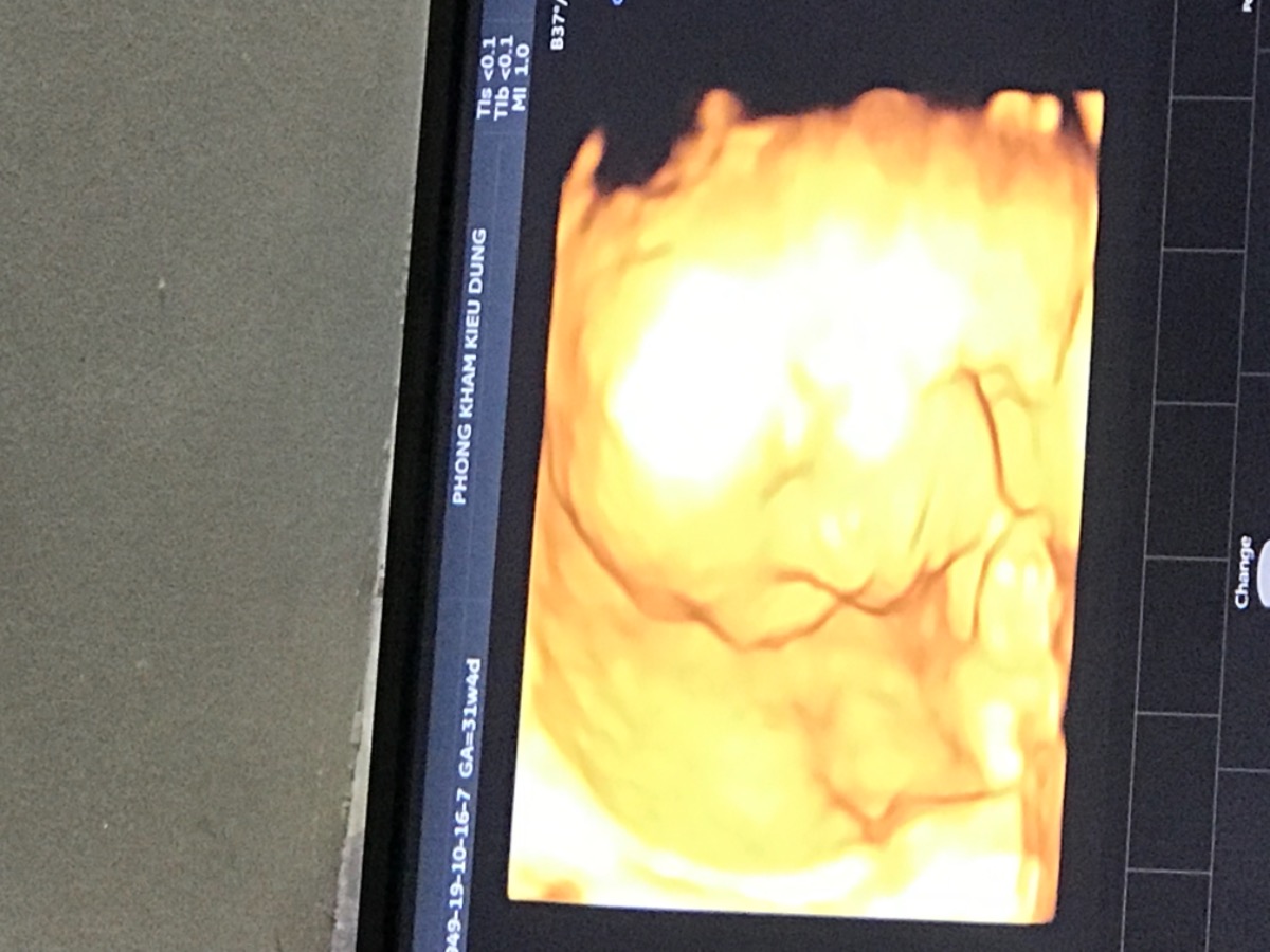 Chuột đực 25 tuần nhà e 🥰🥰🥰
Dự sanh 15/02/2020 🐭❤️