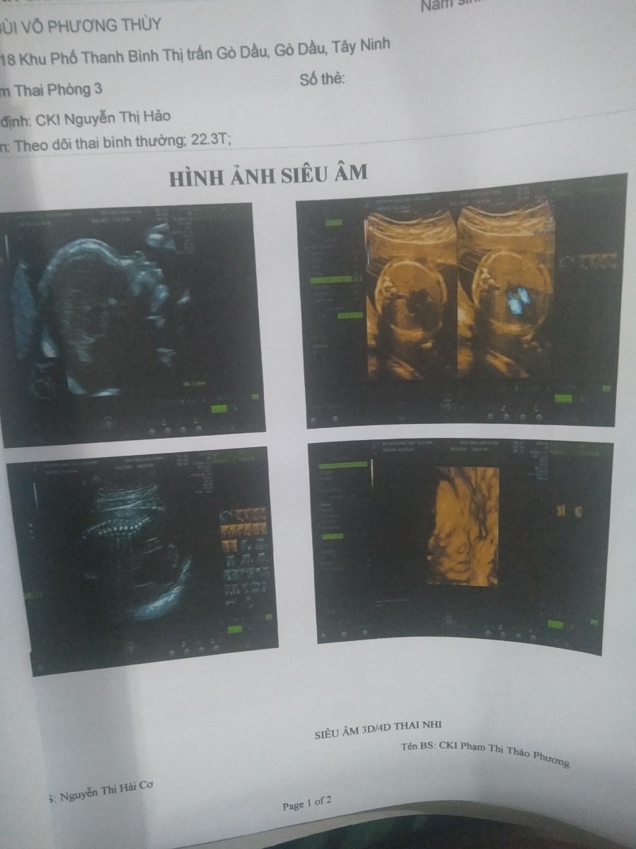 Chuột nhà em các m ạ 22w4. Em vừa thăm hùi sáng.  Bác sĩ nói cân nặng chưa chuẩn lắm mà em đã lên 10kg.  Có m nào giup em có cách nào vào con k vào mẹ k ạ.