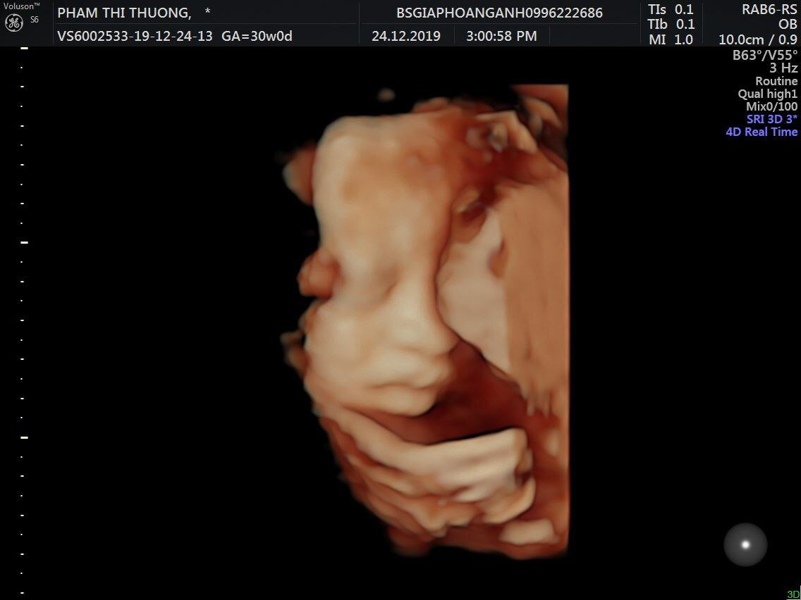 Yêu em của mẹ! 30w -1530g 😍. Sau này lại lùn 1 mẩu r con ơi