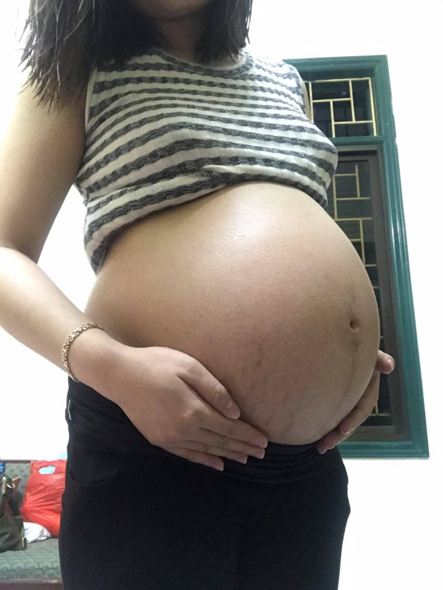 32w6d của e đây ạ. Các mom khoe bụng bầu đi. E tập đầu do cơ địa da mỏng nên dù có bôi đâu dừa với kem rạn của nhật vẫn k ăn thua đây 😅😅