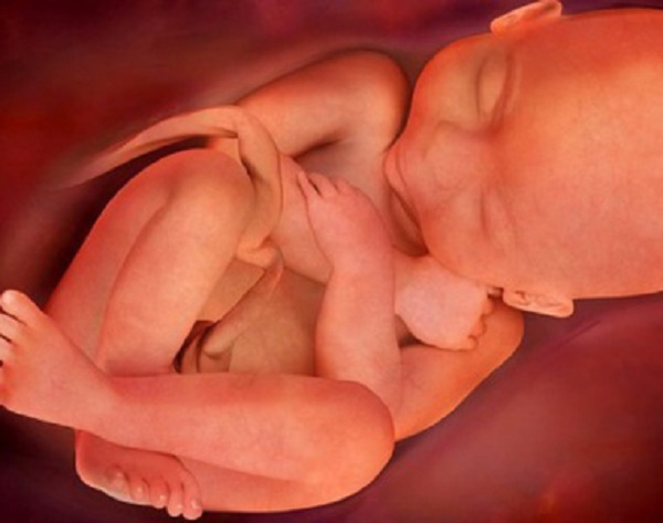 Có nhiều món bà bầu không nên ăn để đảm bảo an toàn cho bản thân và thai nhi. Trước và trong lúc mang thai, mẹ nhất định phải tìm hiểu kĩ để tránh gặp phải những tai biến đáng tiếc.

Mỗi người đều có những món ăn yêu thích riêng. Bình thường thoải mái ăn không sao nhưng khi mang thai mẹ cần tìm hiểu kĩ xem món đó có ăn được không, ăn bao nhiêu là vừa. Bởi vì lúc này cơ thể mẹ thay đổi nhiều, bụng mẹ còn chứa thêm em bé. Nếu ăn bừa bãi, ăn những thứ ảnh hưởng đến tử cung, thai nhi… thì rất nguy hiểm.

Em có bà chị họ từ nhỏ đến lớn ghét ăn khổ qua kinh khủng. Ấy vậy mà không hiểu sao có bầu lại nghén thèm canh khổ qua nhồi thịt. Chị kể là thèm lắm luôn mà mẹ chồng khó tính bắt kiêng, không cho ăn dù là một chén nhỏ. Bầu hơn 3 tháng, một tuần 7 đêm thì hết 3 – 4 đêm ngủ mơ được ăn canh khổ qua nữa là hiểu. Đúng đợt con em chồng ở gần nhà đẻ nên buổi trưa mẹ chồng hay chạy sang đó nấu đồ ăn cho con gái. Ở nhà, chị họ em chớp thời cơ ra vườn hái khổ qua vô nấu canh thịt bò ngồi ăn ngon lành. Chị cứ nghĩ là khổ qua mát, thịt bò lại bổ máu, hai thứ kết hợp lại thành bát canh ngon tốt cho bà bầu chứ có biết gì đâu. Ăn liền gần 1 tuần bỗng dưng buổi sáng ngủ dậy thấy ê ẩm bụng dưới, đi vệ sinh thì tá hỏa thấy quần chíp dính dấu máu. Chị mang thai lần đầu (lấy chồng gần 3 năm mới có con) nên hoảng loạn lắm, khóc bù lu bù loa, ngay lập tức kêu chồng chở đi khám chứ có dám nói năng gì với mẹ chồng đâu vì sợ bị rầy. Cũng may bác sĩ khám bảo chỉ bị bóc tách nhẹ, về nhà chịu khó nằm nhiều, kiêng cữ ăn uống cẩn thận là ổn. Qua đợt đó, chị mới tin là có bầu nên kiêng ăn canh khổ qua vì dễ gây động thai, đau bụng. Em thấy vụ này đúng lắm chứ không phải thừa đâu. Mẹ nào có thai nhất định phải kiêng cữ chuyện ăn uống chứ chủ quan là có ngày hối hận. Ngoài khổ qua thì còn 20 món dưới đây cũng nên kiêng khi mang bầu:

Có nhiều món bà bầu không nên ăn để đảm bảo an toàn cho bản thân và thai nhi

1/ Thực phẩm chứa vi khuẩn listeria

Những thực phẩm hay chứa vi khuẩn listeria là: thịt muối, pho mát mềm, sữa chưa tiệt trùng. Mẹ bầu sức đề kháng yếu, bụng dạ yếu cộng với thai nhi còn non nớt, nếu ăn phải lượng vi khuẩn listeria lớn thì rất dễ bị đau bụng, nôn ói, loét dạ dày, động thai.

2/ Cá chứa thủy ngân

Các loại cá có kích thước lớn ngoài khơi xa thường bị nhiễm thủy ngân nặng. Điển hình là cá mập, cá kiếm, cá thu, cá kình… Trong thời gian mang thai, mẹ vẫn được phép ăn nhưng nếu ăn quá nhiều, quá thường xuyên thì cơ thể sẽ bị dung nạp lượng thủy ngân lớn. Thủy ngân là chất cực độc có thể khiến thai nhi bị dị dạng, tổn thương não, chậm phát triển, ảnh hưởng đến sức khỏe và trí tuệ của con sau này.

3/ Động vật có vỏ sống 

Các loại hải sản, thủy sản như hàu, trai, ốc, hến giàu canxi và dưỡng chất cần thiết cho cơ thể mẹ và thai nhi. Tuy nhiên, chúng sống ở đáy nước, ngay lớp cát, bùn… nên thường nhiễm kí sinh trùng, chất bẩn… Mẹ bầu muốn ăn phải chọn ăn loại còn tươi, đem vệ sinh, ngâm rửa kĩ và nấu chín. Nếu vỏ của chúng chưa mở thì mẹ không nên ăn vì có thể con đó còn sống.

4/ Gan động vật

Gan chứa một số chất bổ cho cơ thể (điển hình là vitamin A). Tuy nhiên, bà bầu và trẻ nhỏ không nên ăn nhiều vì đây vốn là bộ máy giải độc, là “kho” chứa nhiều chất độc hại trong cơ thể gà, heo, bò… Mặt khác, mẹ mang thai 3 tháng đầu kiêng kỵ ăn nhiều vitamin A vì dễ gây quái thai.

5/ Đậu nành và các sản phẩm từ đậu nành

Có nhiều nghiên cứu gây tranh cãi về tác dụng của đậu nành tới sức khoẻ sinh sản của bé trai. Cụ thể thì một số nhà khoa học cho rằng đậu nành nhiều hoóc môn sinh sản nữ (oestrogen) nên có thể gây ra các bất thường ở cơ quan sinh sản của bé trai. Tốt nhất, mẹ bầu nên ăn uống các sản phẩm làm từ đậu nành một cách vừa phải.

6/ Măng tươi

Măng tươi có vị đắng, hơi the… Loại thực phẩm này tuy chế biến được nhiều món khoái khẩu (ví dụ: măng xào thịt, bún măng gà, gỏi măng…) nhưng lại có hàm lượng Cyanide rất cao (khoảng 230mg/kg). Mẹ bầu ăn nhiều măng chứa Cyanide có thể tạo thành chất độc Acid Cyanhydric (HCN) gây hại cho thai.

7/ Khoai mì

Các món ăn làm từ khoai mì rất dân dã, nhiều người khoái khẩu (khoai mì hấp nước cốt dừa, bánh tằm mì, bánh khoai mì nướng…). Tuy nhiên, đây là thực phẩm chứa nhiều axit cyanhydric (chứa nhiều nhất trong khoai mì cao sản) nên bà bầu ăn vào dễ bị rối loạn tiêu hóa, ngộ độc thức ăn, ảnh hưởng đến hệ thần kinh của thai nhi.

8/ Rau ngót

Mẹ bầu thai yếu, động thai, có tiền sử sảy thai, động thai, đẻ non, hiếm muộn… thì nên hạn chế ăn rau ngót để tránh xảy ra biến chứng nguy hiểm. Đây là món bà bầu không nên ăn trong 3 tháng đầu và cả những tháng sau (nếu thai yếu) mà mẹ nhất định phải biết.

9/ Ngải cứu

Ăn ngải cứu bồi bổ cho thai. Có nhiều bài thuốc chữa động thai với nguyên liệu từ ngải cứu và trứng gà. Tuy nhiên, nếu mẹ bầu ăn với lượng lớn có thể làm sẩy thai ngay lập tức. Tốt nhất là cẩn trọng khi ăn món này.

10/ Cà phê

Hiện nay, cà phê là thức uống khá thân thuộc với nhiều người. Tuy nhiên, với các mẹ bầu thì nên hạn chế vì nó chưa cafein. Chất này đi qua nhau thai làm rối loạn quá trình phát triển của thai nhi, ảnh hưởng đến hệ thần kinh của trẻ. Dân gian còn quan niệm rằng bà bầu uống cà phê nhiều thì con sinh ra sẽ có làn da đen thui xấu xí.

11/ Đu đủ xanh

Đu đủ xanh tốt cho sản phụ sau sinh vì kích thích tiết sữa nhưng đối với bà bầu thì không nên ăn. Lý do là trong loại quả này chứa nhiều enzym và nhựa kích thích tử cung co thắt, dẫn đến đau bụng, sẩy thai. Nhất là đối với những mẹ đang mang thai 3 tháng đầu.

12/ Thơm (dứa)

Tương tự với đu đủ xanh, trái thơm cũng là món bà bầu không nên ăn. Loại quả này có chứa một chất tên là bromelain. Chất này có tác dụng làm mềm tử cung, kích thích co bóp tử cung và sản xuất các chất gây phá thai. Cho nên mẹ bầu nên kiêng bớt loại quả này để đảm bảo an toàn cho thai. Khi nào sắp đến ngày sinh thì mới nên ăn để dễ đẻ.

13/ Nhãn

Ăn nhiều nhãn khi mang thai là không nên. Đây là loại quả có tính nóng, mẹ ăn nhiều sẽ dễ bị ợ chua, táo bón, mẩn ngứa, dị dứng, da sạm nám, xáo trộn sự phát triển của thai nhi.

14/ Rượu bia, nước ngọt, đồ uống có gas

Đây là những thức uống cấm kỵ đối với mẹ bầu vì những hậu quả: quái thai, ảnh hưởng não, thể chất của trẻ. Mẹ nào lạm dụng thì con sinh ra rất dễ mắc các tổn thương thần kinh, nguy cơ bệnh đao là khá lớn. Ngoài ra, mẹ bầu cũng tránh uống 8 loại nước thơm ngon nhưng làm cạn ối, gây hại cho bào thai được bác sĩ khuyến cáo thường xuyên.

15/ Rau mầm

Rau mầm thực ra là một loại rau khá bổ. Tuy nhiên, phụ nữ không được khuyến khích ăn rau mầm vì với loại chôn ủ không đảm bảo vệ sinh rất dễ nhiễm vi khuẩn gây bệnh đường tiêu hóa. Mặt khác, rau mầm bày bán tràn lan ngoài chợ hiện nay phần lớn đều dùng hóa chất tăng trưởng để rút ngắn thời gian sản xuất lại. Mẹ bầu ăn vào rất có hại cho quá trình phát triển của thai nhi.

16/ Dưa muối

Trong những ngày đầu, vi sinh vật sẽ chuyển hóa nitrat trong các nguyên liệu thành nitric, làm hàm lượng nitric tăng cao, độ pH giảm dần (có nghĩa là độ chua tăng dần lên). Mẹ bầu ăn dưa muối ở giai đoạn này rất có hại cho cơ thể và thai nhi. Đồng thời, dưa muối chứa lượng muối lớn cũng không hề tốt cho sức khỏe mẹ bầu (nhất là những mẹ có tiền sử bệnh cao huyết áp, tiền sản giật).

17/ Kem lạnh

Kem lạnh nói riêng và tất cả những đồ ăn lạnh, có đá lạnh nói chung đều không tốt cho sức khỏe thai phụ. Ăn quá nhiều kem sẽ khiến các mạch máu bị co thắt đột ngột, huyết dịch giảm, sức đề kháng cục bộ cũng giảm mạnh theo. Điều này tạo cơ hội cho vi khuẩn, vi-rút trong khoang mũi, khoang miệng, khí quản tấn công, gây ho, đau rát cổ họng, đau đầu…. Đó là chưa kể dung nạp nhiều thức ăn lạnh khiến mẹ dễ bị đau nhức bụng dưới.

20-mon-ba-bau-khong-nen-an-vi-gay-hai-cho-thai-me-gap-tai-bien-nguy-hiem-09

18/ Đồ ăn nhiều dầu mỡ

Các đồ ăn thức uống nhiều dầu mỡ không được khuyến khích đối với phụ nữ mang thai. Thứ nhất, mẹ dung nạp quá nhiều chất béo khiến hệ tiêu hóa làm việc quá sức, dễ bị ợ chua, nặng bụng, khó tiêu. Thứ hai, chất béo khiến mẹ bầu tăng cân quá mức và quá nhanh, làm trầm trọng hơn bệnh tiểu đường, tim mạch, béo phì, nguy cơ tiền sản giật…

19/ Trà

Cùng với rượu bia, cà phê thì trà cũng là thức uống mẹ bầu nên kiêng cữ bớt. Trà có chứa nhiều chất kích thích. Mẹ cũng nên lưu ý rằng kiêng uống trà không đơn thuần chỉ là trà pha truyền thống mà còn là trà thảo mộc, trà sữa… mẹ đều phải hạn chế hết mức có thể vì nó không hề có lợi cho sự phát triển của thai nhi. Tuy nó không hẳn là món bà bầu không nên ăn để tránh sảy thai nhưng nó dễ khiến thai nhi kém thông minh và khiến mẹ bầu bị mất ngủ.

20/ Trứng lộn 

Trứng vịt lộn, trứng cút lộn có hàm lượng đạm cao. Mẹ bầu có thể ăn 1 tuần 2-3 quả để bồi bổ cho thai nhi. Nếu ăn quá nhiều thì lại phản tác dụng vì gây chậm tiêu, sinh ra nhiều cholesterol. Giai đoạn cuối thai kỳ, nhiều mẹ hay cố ăn trứng lộn thường xuyên để tăng ký nhanh cho thai. Điều này không được bác sĩ khuyến khích vì kéo theo nhiều hệ lụy cho sức khỏe. Tốt nhất, mẹ nên lựa chọn phương án khác như uống sữa tươi, các loại nước ép… để tăng ký cho thai.

20-mon-ba-bau-khong-nen-an-vi-gay-hai-cho-thai-me-gap-tai-bien-nguy-hiem-10

Ngoài 20 món nên kiêng trên thì mẹ bầu chú ý ăn nhiều những loại thực phẩm dưới đây:

-Cá hồi: cung cấp nguồn omega-3 dồi dào, phát triển não bộ của bé và hệ thần kinh trung ương. Không nên ăn quá 2 lần/tuần.

-Cháo cá chép: Ăn cháo cá chép hạt sen giúp bồi dưỡng thai nhi lớn khỏe. Người ta còn tin rằng nó giúp con sinh ra có làn da trắng, môi hồng.

-Thịt nạc đỏ: Giàu chất sắt, cấu tạo hồng cầu cho trẻ nhỏ, ngăn ngừa thiếu máu trong và sau thai kỳ.

-Rau bina: giúp phát triển tế bào máu, vận chuyển oxi đi khắp cơ thể mẹ và cung cấp cho thai nhi.

-Sữa tươi không đường: Cung cấp đạm, canxi giúp hình thành khung xương cho thai nhi và ngăn ngừa nguy cơ loãng xương cho mẹ bầu.

-Bánh mỳ: Cung cấp chất xơ, kẽm, vitamin B (cấu thành tế bào và tốt cho hệ thống miễn dịch của trẻ nhỏ).

-Dầu ô liu: chứa omega-3, omega-6, hợp chất hỗ trợ não bộ là oleocanthal giúp các khớp thần kinh chạy trơn tru, ngăn chặn tình trạng hủy hoại tế bào thần kinh có liên quan đến chứng mất trí nhớ của mẹ bầu và tốt cho tim mạch.

-Trái cây thuộc họ dâu: giàu chất chống oxy hóa, kháng viêm, tăng sức đề kháng.

-Các loại hạt (hạt bí, hạnh nhân, hướng dương, đậu phộng…) chứa omega-3, omega-6, axit folic, vitamin E, vitamin B6 giúp tăng cường trí nhớ và khả năng tập trung.

-Khoai lang: giàu vitamin A dễ hấp thu và an toàn cho thai phụ, không gây dị tật. Mặt khác, loại củ này còn chứa nhiều vitamin C, folate, chất xơ cực tốt cho thai, chống táo bón hiệu quả.

Trên đây là danh sách 20 món bà bầu không nên ăn để đảm bảo an toàn trong suốt 9 tháng 10 ngày mang thai. Ngoài ra, cũng có cả những thực phẩm tốt cho thai được bác sĩ khuyến khích mẹ nên ăn để bồi bổ sức, giúp con lớn nhanh. Các mẹ nên lưu lại để có một chế độ ăn uống hiệu quả, con chào đời bình an, khỏe mạnh.